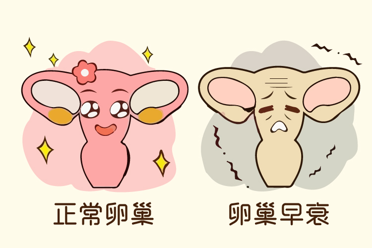 卵巢早衰